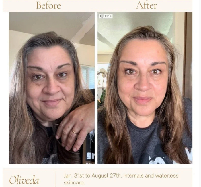 Recommended Oliveda Skincare Regimens by Skin Concern and Type